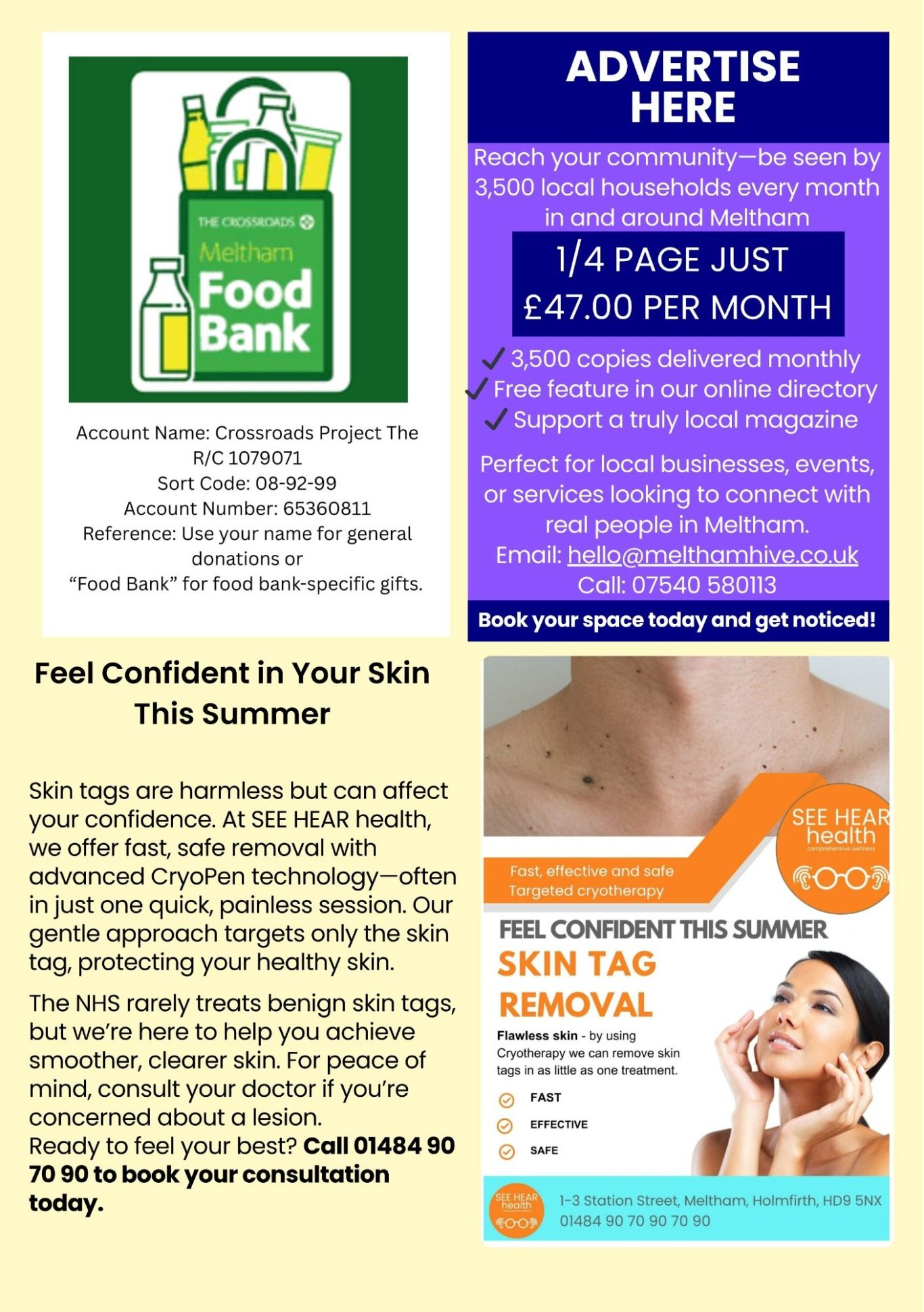 Feel confident this summer with skin tag removal locally